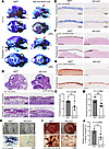 Neural crest–specific Nf2 deletion impairs craniofacial bone development.