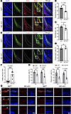 Nf2 deletion disrupts CNC-derived osteoprogenitor proliferation and differe