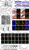 Nf2 regulates type I collagen biosynthesis and secretion in CNC-derived ost