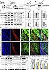 Nf2 scaffolds FGFR1/Akt signaling to regulate CNC-derived osteoblast functi