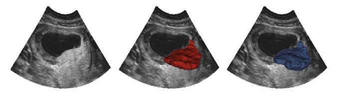 OxNNet compared to groundtruth.
Placental segmentations with 2D B-mode p...