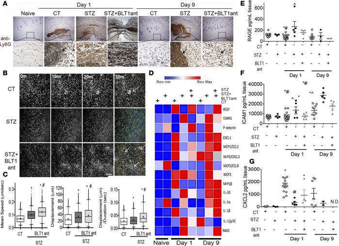 Excessive LTB4 production drives poor neutrophil organization and altere...