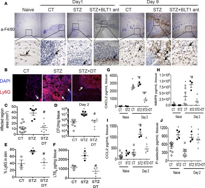 Skin-macrophages drive detrimental host defense actions in diabetic mice...