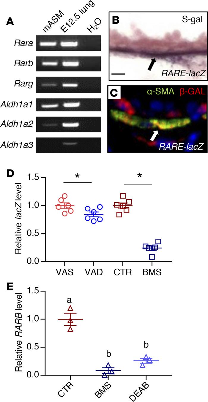 RA signaling is active in adult ASM.
(A) PCR analysis of mASM showing th...