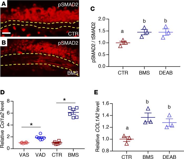 TGF-β is activated in RA-deficient ASM.
(A and B) Immunostaining of phos...