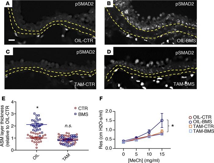 Deletion of TGF-β receptor 2 (Tgfbr2) in mouse smooth muscle in vivo pre...