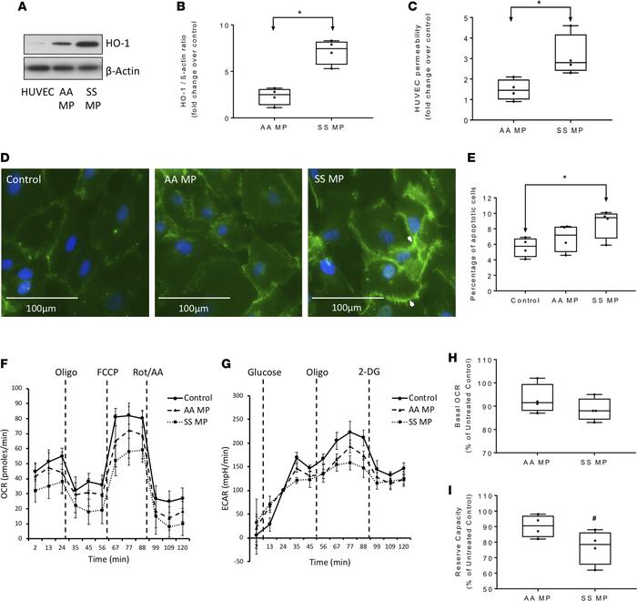 Townes-SS RBC–derived microparticles promote toxicity in human endotheli...