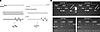 Minus strand transcript generation in AAV-transduced cells.