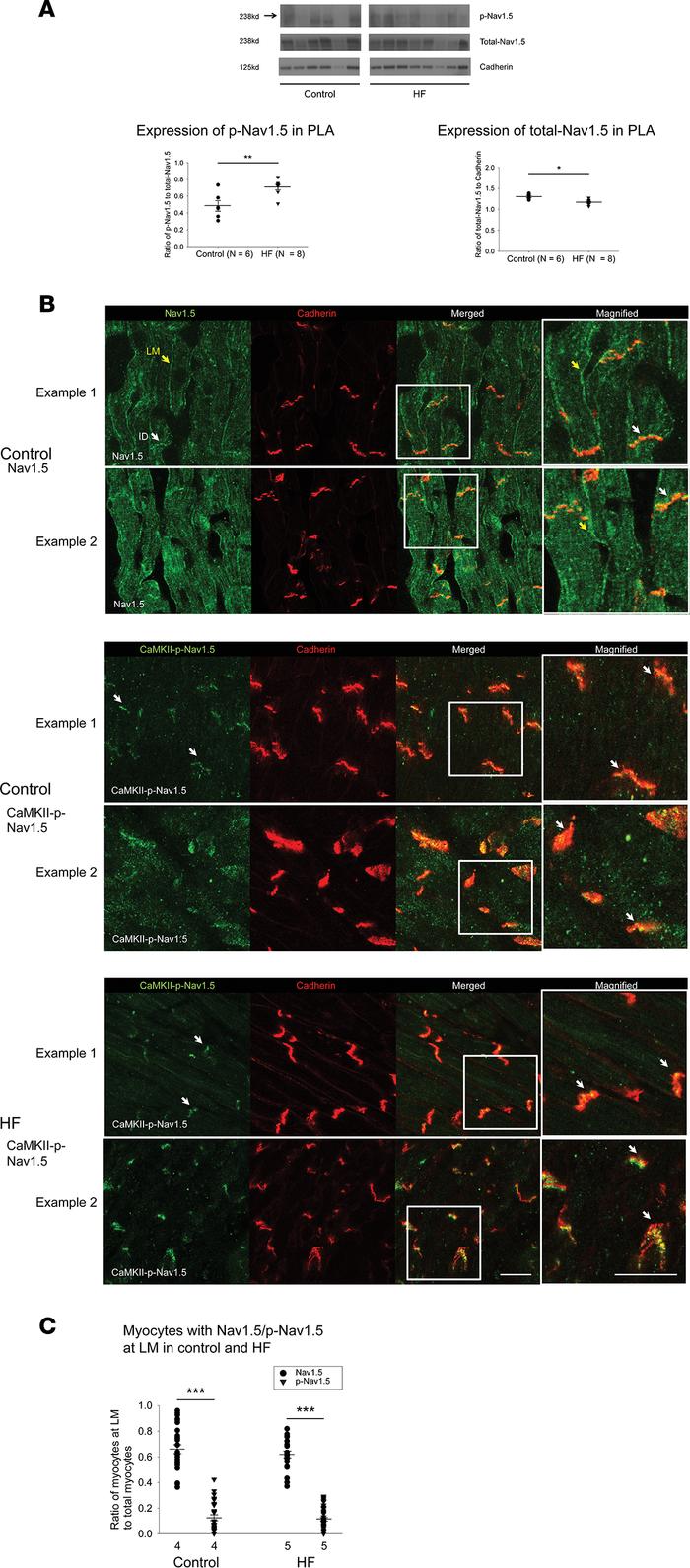 Increased expression of CaMKII-phosphorylated Nav1.5 at serine 571 in HF...