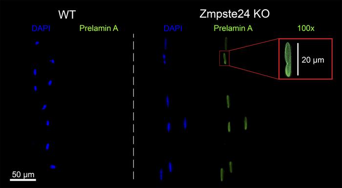 Prelamin A accumulation in Zmpste24-deficient myonuclei.
Typical EDL myo...