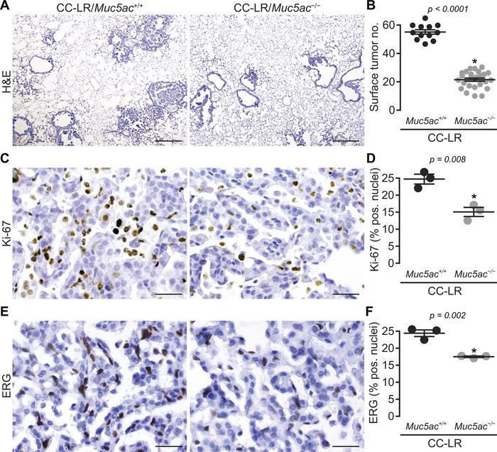 Lack of Muc5ac suppresses Kras-induced lung tumorigenesis.
(A) Histopath...