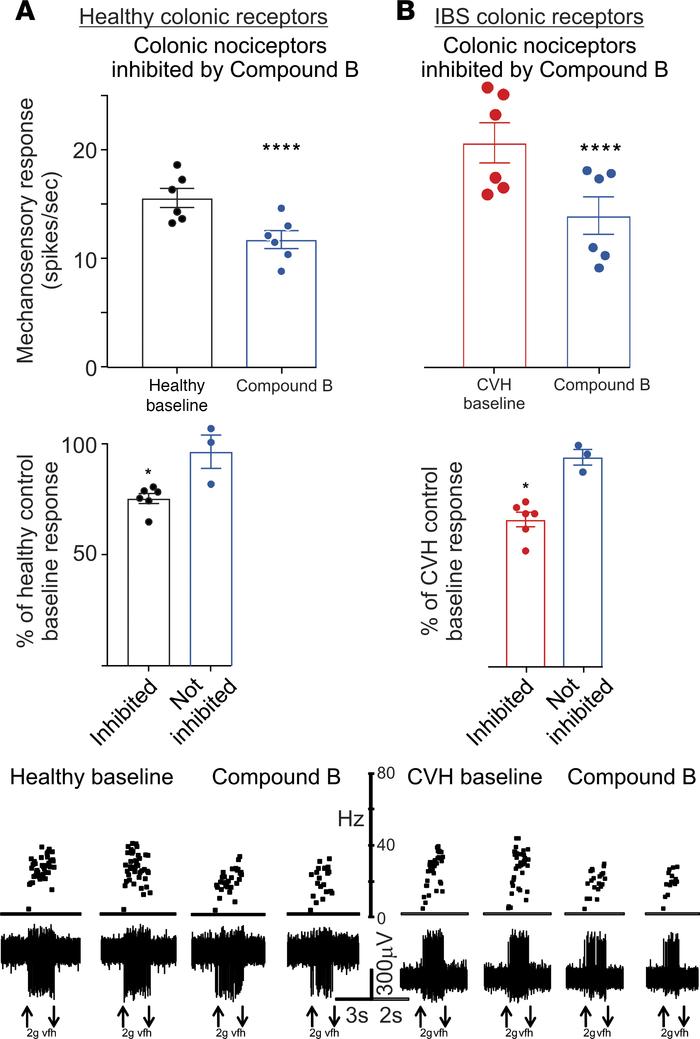 Effect of Compound B on colonic nociceptive afferents.
(A) Top panel: Ap...