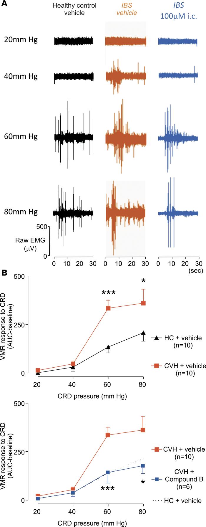Effect of intracolonic administration of Compound B on VMR in an IBS mou...