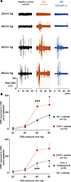 Effect of intracolonic administration of Compound B on VMR in an IBS mouse