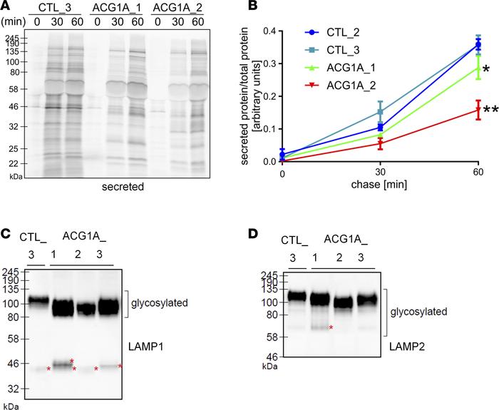 Reduced secretory trafficking and defective glycoprocessing in achondrog...