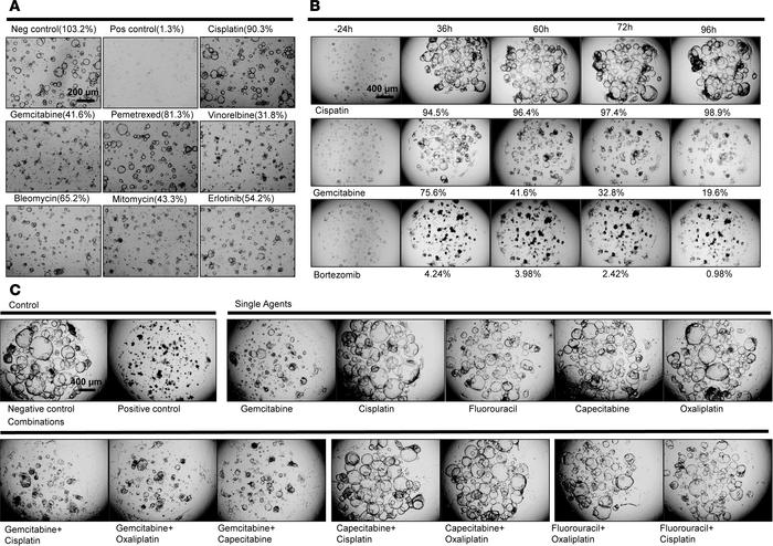 Low-throughput and high-throughput drug testing in cancer organoid lines...