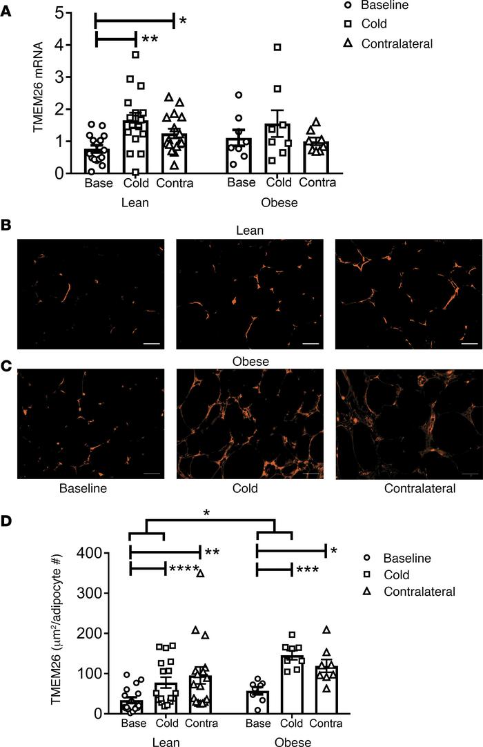 Repeated cold exposure induces transmembrane protein 26 (TMEM26) in huma...