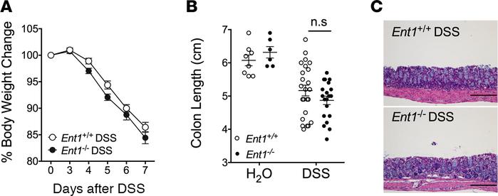 Loss of Ent1 does not protect the colonic mucosa during experimental col...