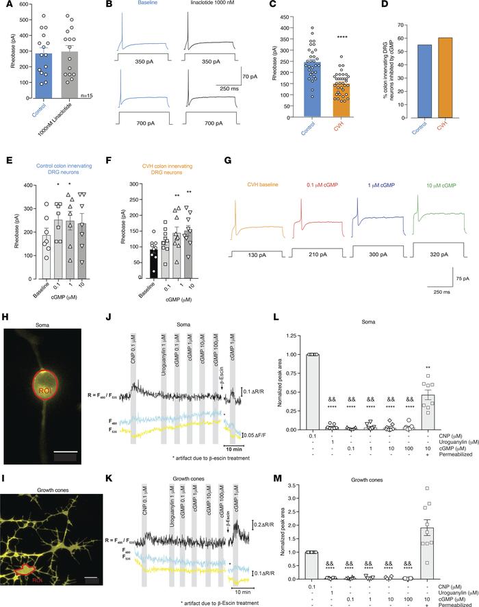 Exogenous cGMP inhibits colon-innervating DRG neurons via a membrane tar...