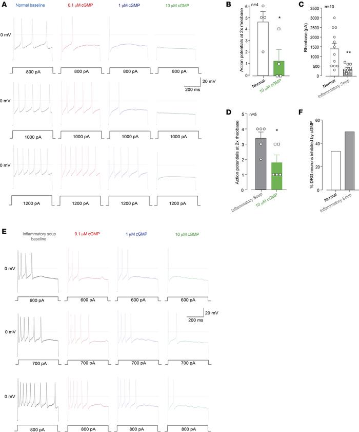 Exogenous cGMP inhibits human DRG neurons.
(A) Whole-cell current-clamp ...