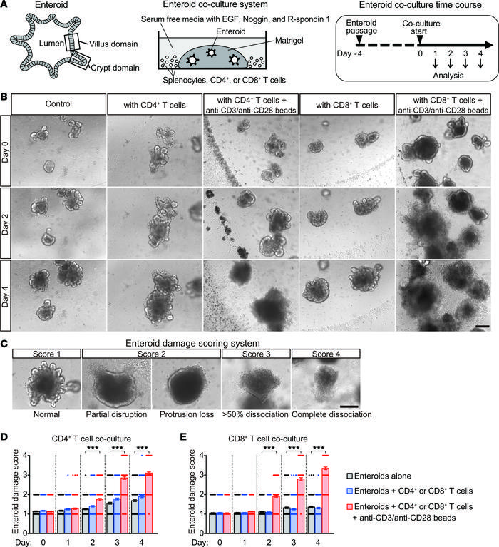 Activated T cells induce enteroid damage.
(A) Overall design of enteroid...