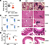 Hrd1fl/fl-FoxP3cre mice developed age-related spontaneous multiorgan inflam