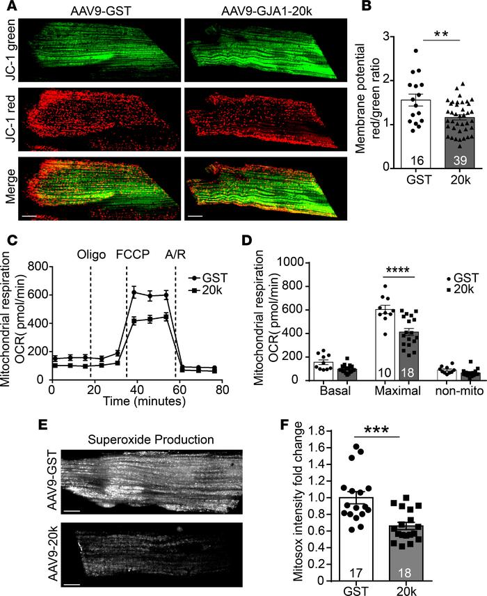 GJA1-20k promotes mitochondrial quiescence.
(A) Cardiomyocytes isolated ...
