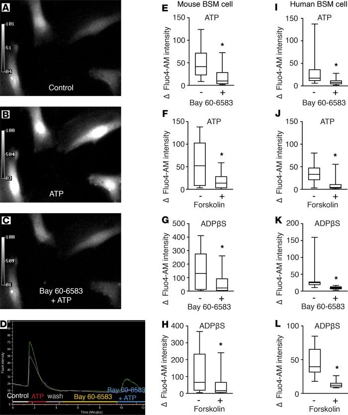 AC-cAMP signaling regulates bladder smooth muscle purinergic contractili...