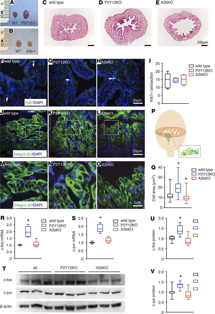 P2Y12 and A2b signaling modulate bladder smooth muscle cell growth diffe...