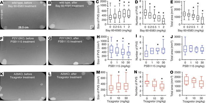 P2Y12 and A2b receptors are drug targets for the treatment of lower urin...
