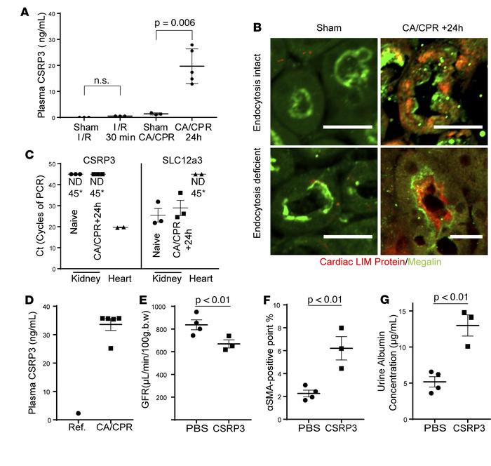 Cardiac LIM protein originates outside the kidney in cardiac arrest and ...