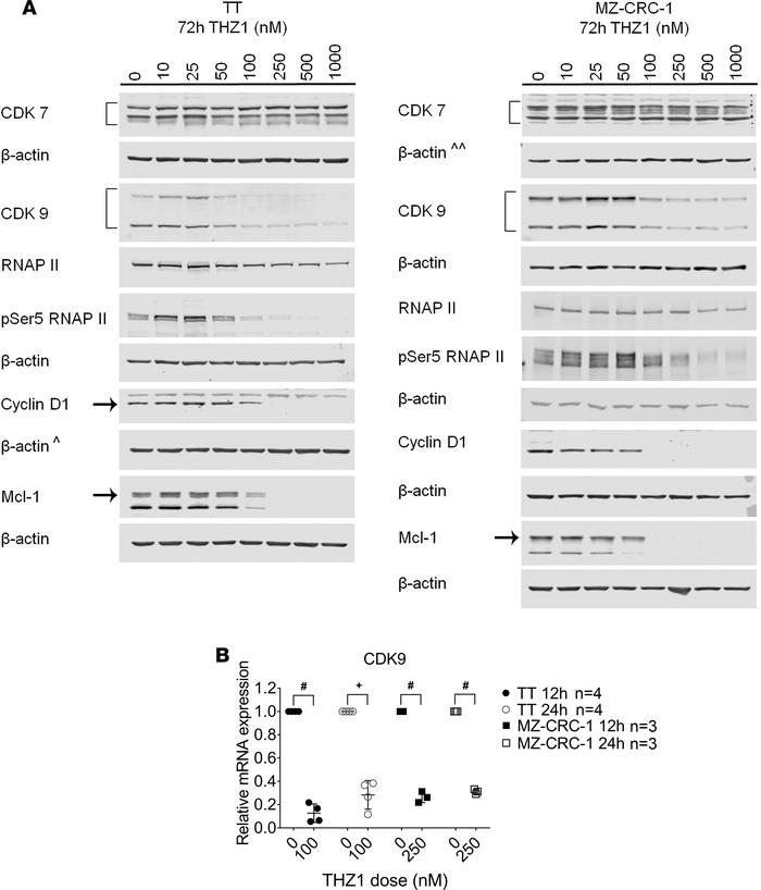 Downregulation of CDK9 protein and mRNA in TT and MZ-CRC-1 cells with TH...
