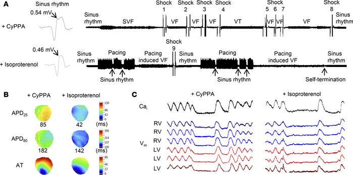 Isoproterenol is antiarrhythmic in CyPPA-induced J wave syndrome.
Protoc...