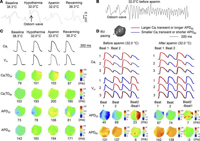 
IKAS activation induces Osborn waves and phase 2 repolarization alterna...