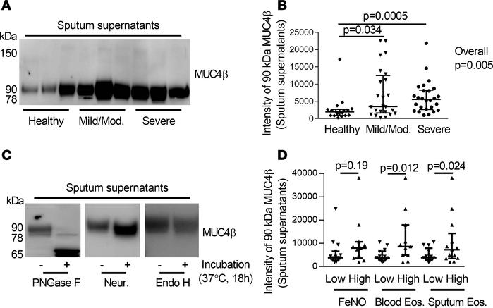 N-glycosylated 90-kDa MUC4β was higher in asthmatic sputum supernatants ...