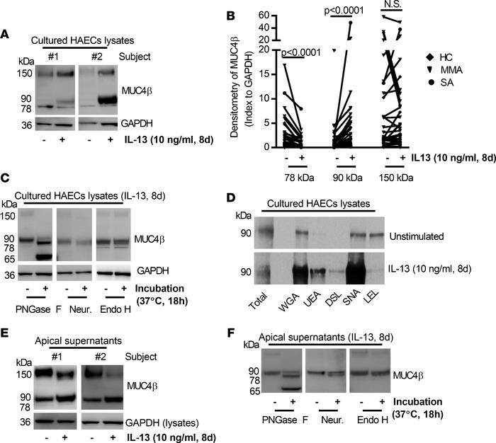 Effects of IL-13 on MUC4β N-glycosylation/secretion and lectin-binding c...