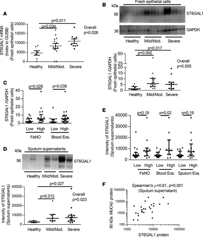 The levels of ST6GAL1 mRNA/protein and association with T2 inflammation ...