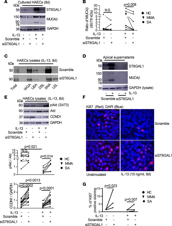 ST6GAL1 knockdown decreased sialylated MUC4β but enhanced proliferative ...