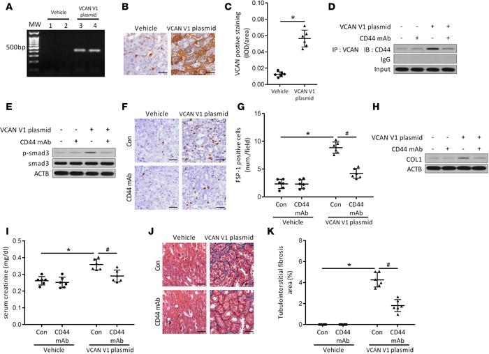 Effect of versican V1 overexpression on tubulointerstitial fibrosis in m...