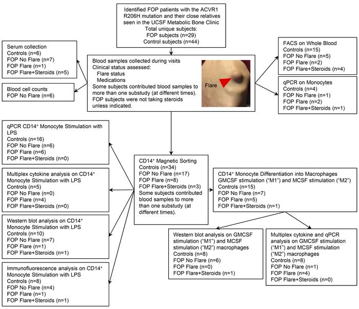 Patient samples flow diagram.
Picture represents a flare from a FOP pati...
