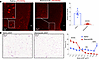 Oral administration of abemaciclib reversed pRb phosphorylation in the MBH