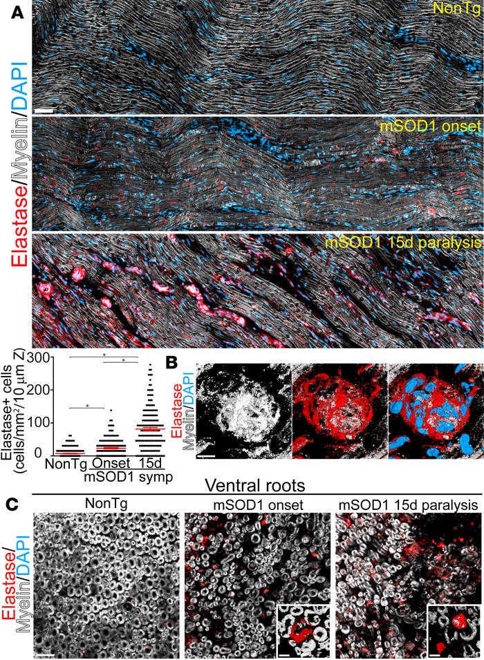 Neutrophils infiltrate into the degenerating sciatic nerve and ventral r...