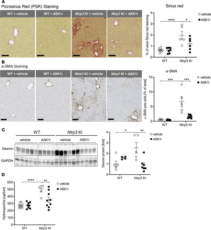 ASK1 inhibition reduced hepatic fibrosis in Nlrp3-KI mice.
(A and B) We ...