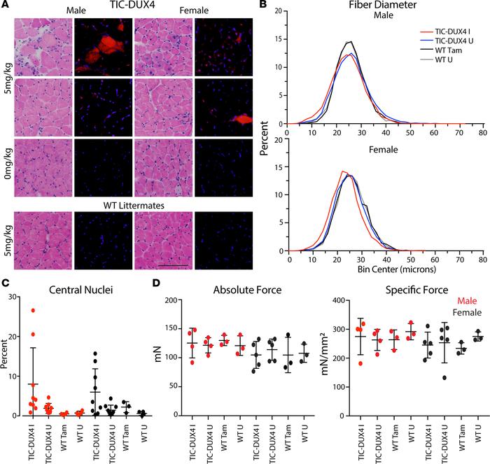 Variable histopathology and no significant functional deficits in TIC-DU...