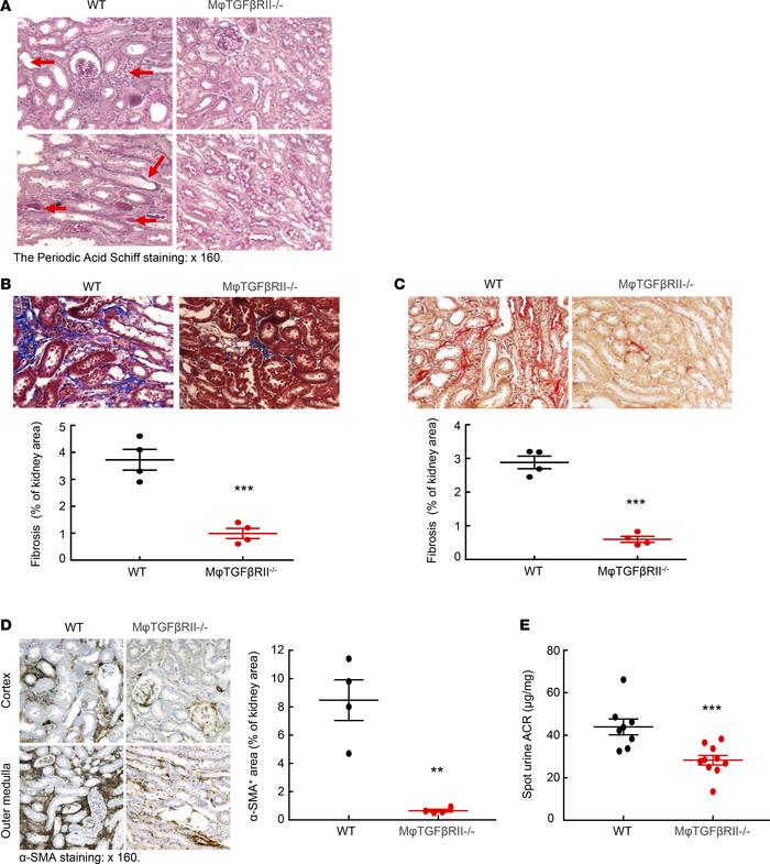 Macrophage TGF-βRII deletion decreased renal fibrosis in an AKI/CKD mode...