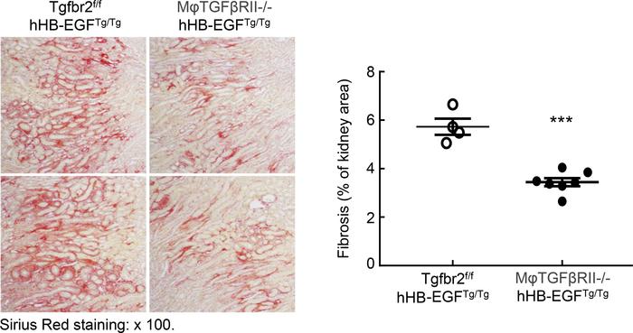 Macrophage TGF-βRII deletion inhibited the development of renal tubuloin...