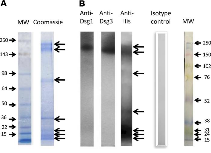 Identification of binding partners of PpSP32 by coimmunoprecipitation.
T...