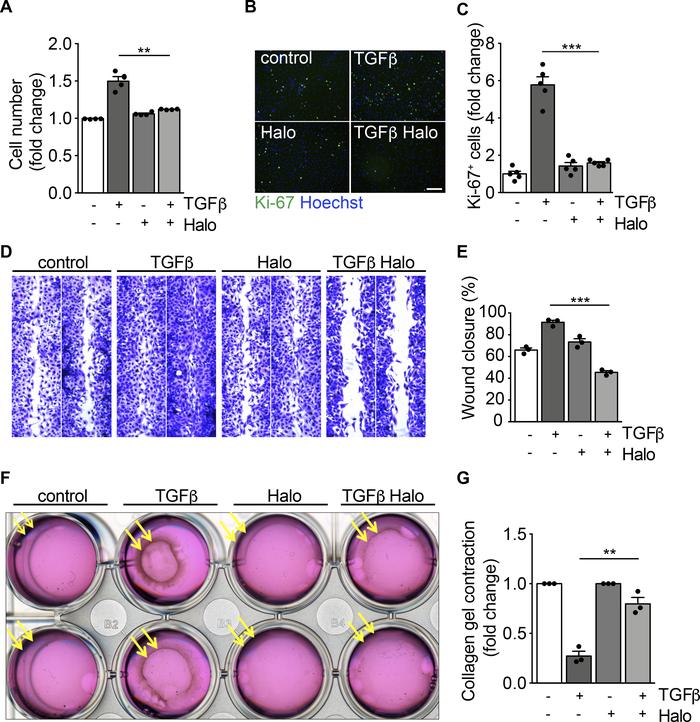 Haloperidol inhibits myofibroblast proliferation, migration, and contrac...