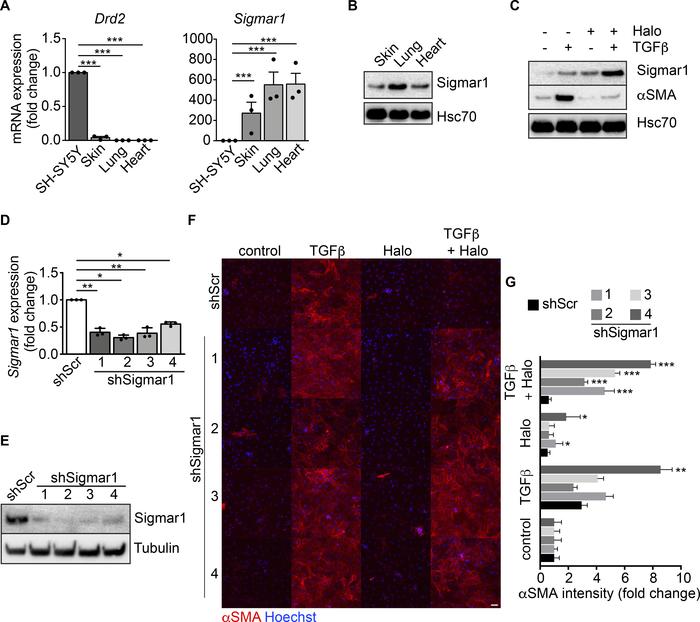 Sigmar1 mediates haloperidol activity in fibroblasts.
(A) Relative mRNA ...
