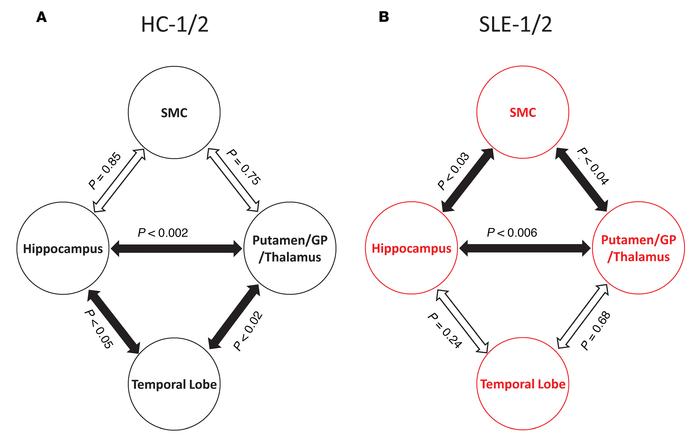 Altered pattern of interregional metabolic correlations between abnormal...
